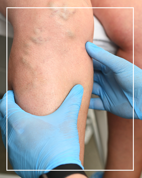 lymphedema_doctor_square